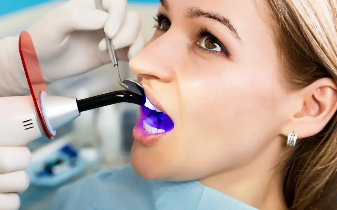 The Top 8 Disadvantages of Teeth Bonding